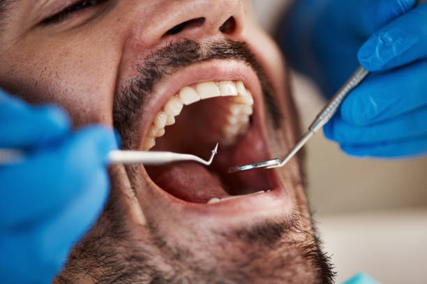 Best After-Hours Emergency Dentist in Hendersonville, NC