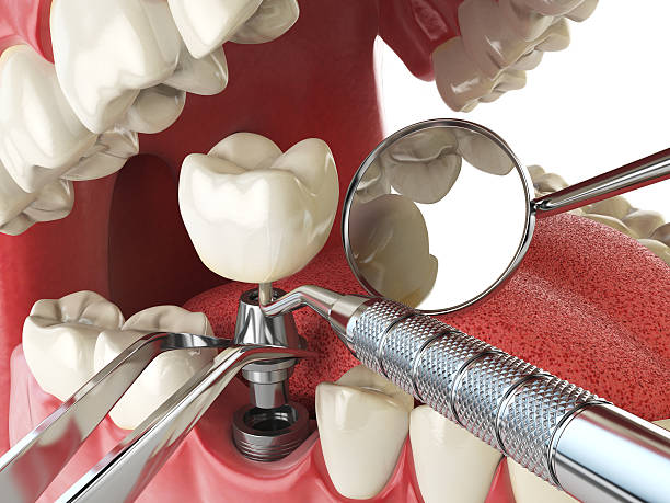 Best Emergency Dental Care for Trauma or Injury in Hendersonville, NC